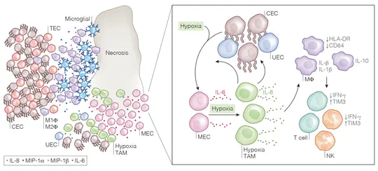 Characterizing the immunobiology of high risk pediatric ependymoma