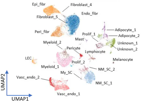 Integration of single-nuclei RNA-sequencing and spatial transcriptomics defines the complex microenvironment of NF1-associated plexiform neurofibromas